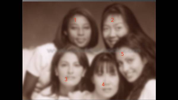 混血雙眼皮（歐式大平行雙眼皮）的真實概念不是高寬平行眼皮和開