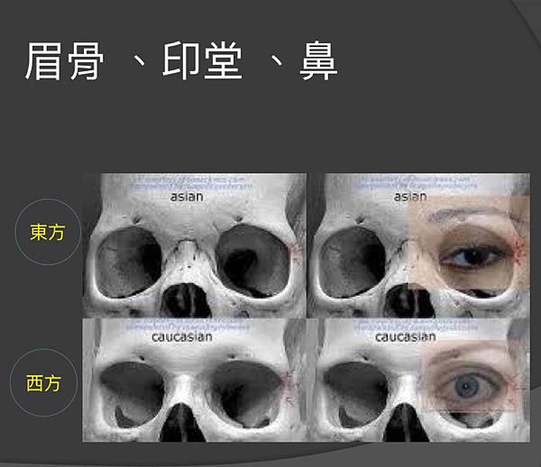 混血雙眼皮（歐式大平行雙眼皮）的真實概念不是高寬平行眼皮和開