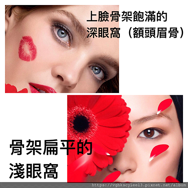 混血雙眼皮（歐式大平行雙眼皮）的真實概念不是高寬平行眼皮和開