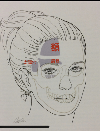 豐額後遺症：手術墊額頭假體出現邊界，為什麼？