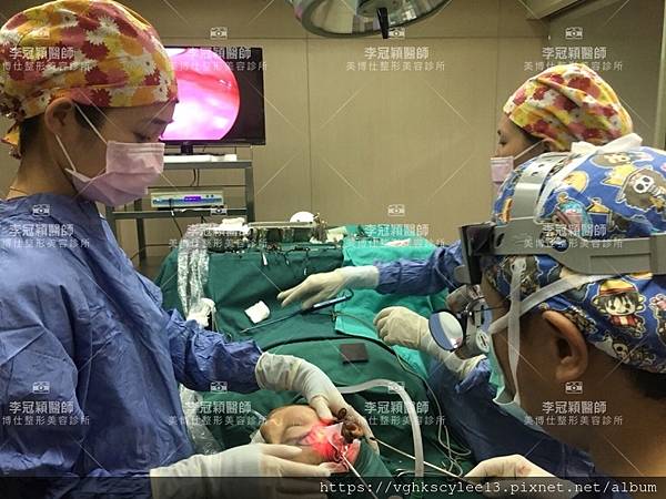 東方臉墊眉骨(隆眉骨)的輪廓效果,顏面T區打造的逆轉! 東方臉墊眉骨(隆眉骨)的輪廓效果,顏面T區打造的逆轉!