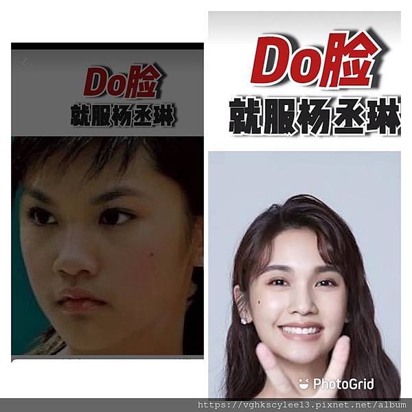 東方臉墊眉骨(隆眉骨)的輪廓效果,顏面T區打造的逆轉! 東方臉墊眉骨(隆眉骨)的輪廓效果,顏面T區打造的逆轉!