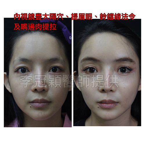 IMG_0296.JPG - 太陽穴