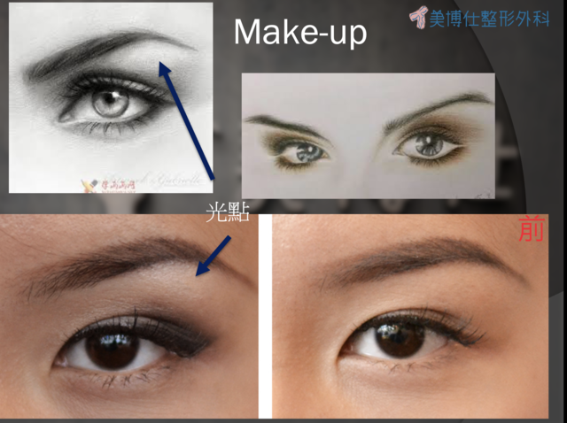 東方臉墊眉骨(隆眉骨)的輪廓效果,顏面T區打造的逆轉! 東方臉墊眉骨(隆眉骨)的輪廓效果,顏面T區打造的逆轉!