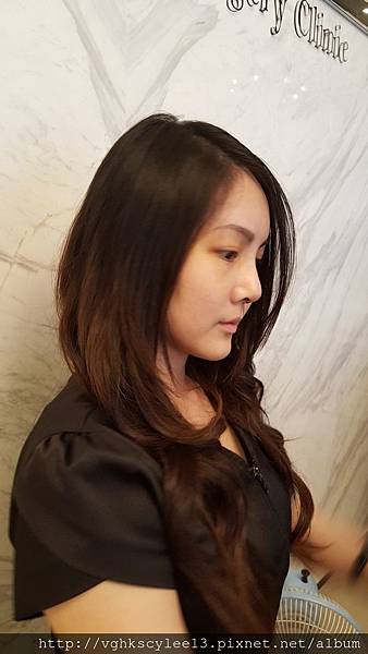 俏鼻不是韓式鼻翹！『鼻額弧線』會是另一個貼近東方特性的鼻線條