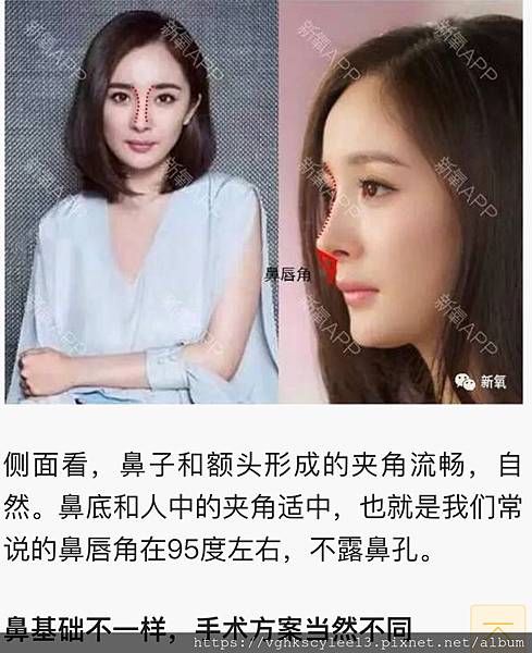 俏鼻不是韓式鼻翹！『鼻額弧線』會是另一個貼近東方特性的鼻線條