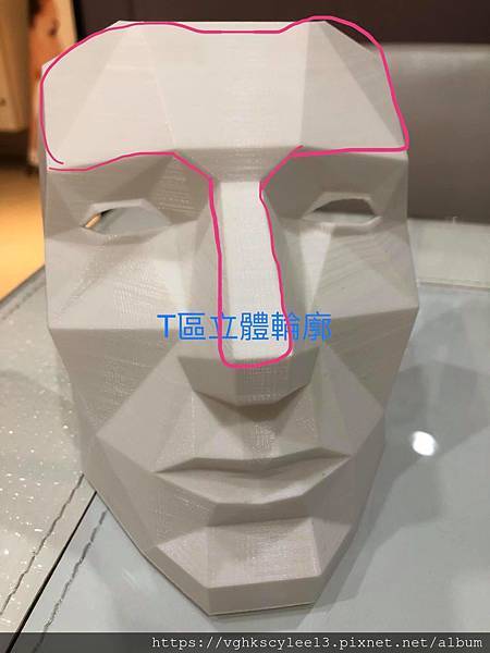 妳的國產臉條件能做Y型鼻（Y字眉心）嗎？和y鼻根有何不同？A