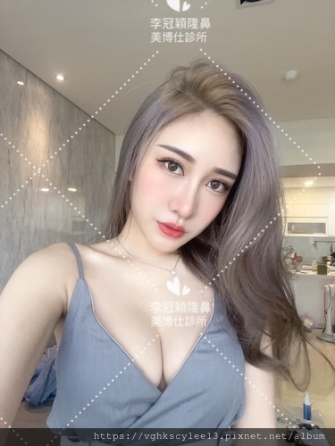 妳的國產臉條件能做Y型鼻（Y字眉心）嗎？和y鼻根有何不同？A