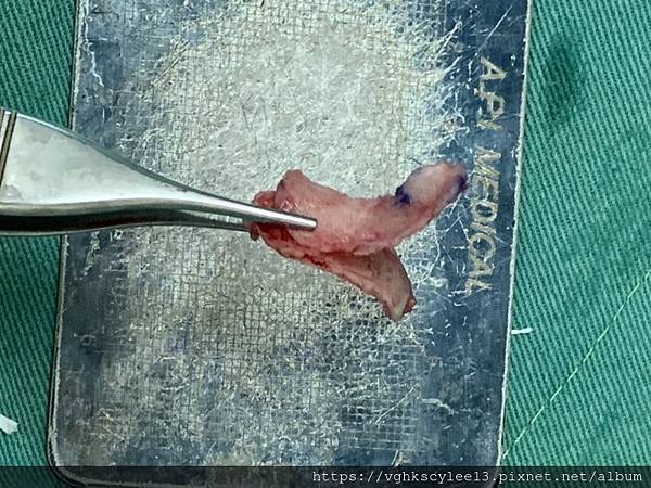 隆鼻價位多少?為什麼差異大!原因? 隆鼻價位多少?為什麼差異大!原因?