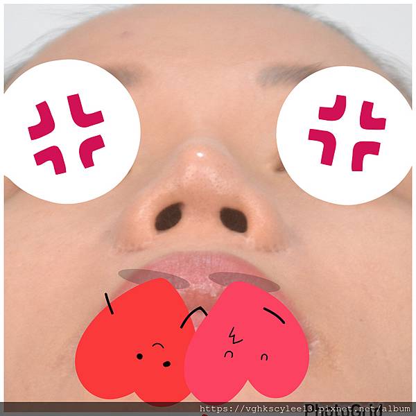 隆鼻價位多少?為什麼差異大!原因? 隆鼻價位多少?為什麼差異大!原因?