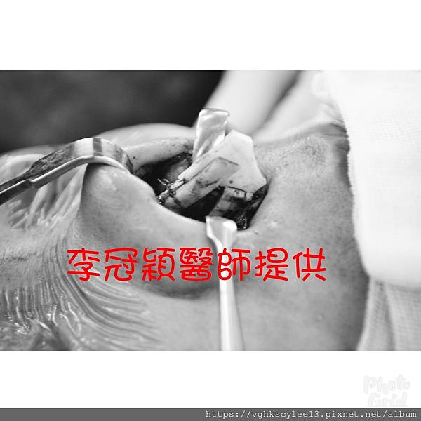 隆鼻價位多少?為什麼差異大!原因? 隆鼻價位多少?為什麼差異大!原因?