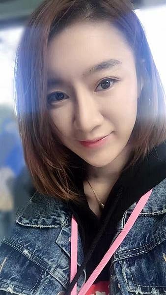 墊額頭『順便』拉頭皮但是留下大疤痕... 難接受😔😔😔。如果