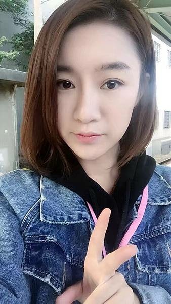 墊額頭『順便』拉頭皮但是留下大疤痕... 難接受😔😔😔。如果