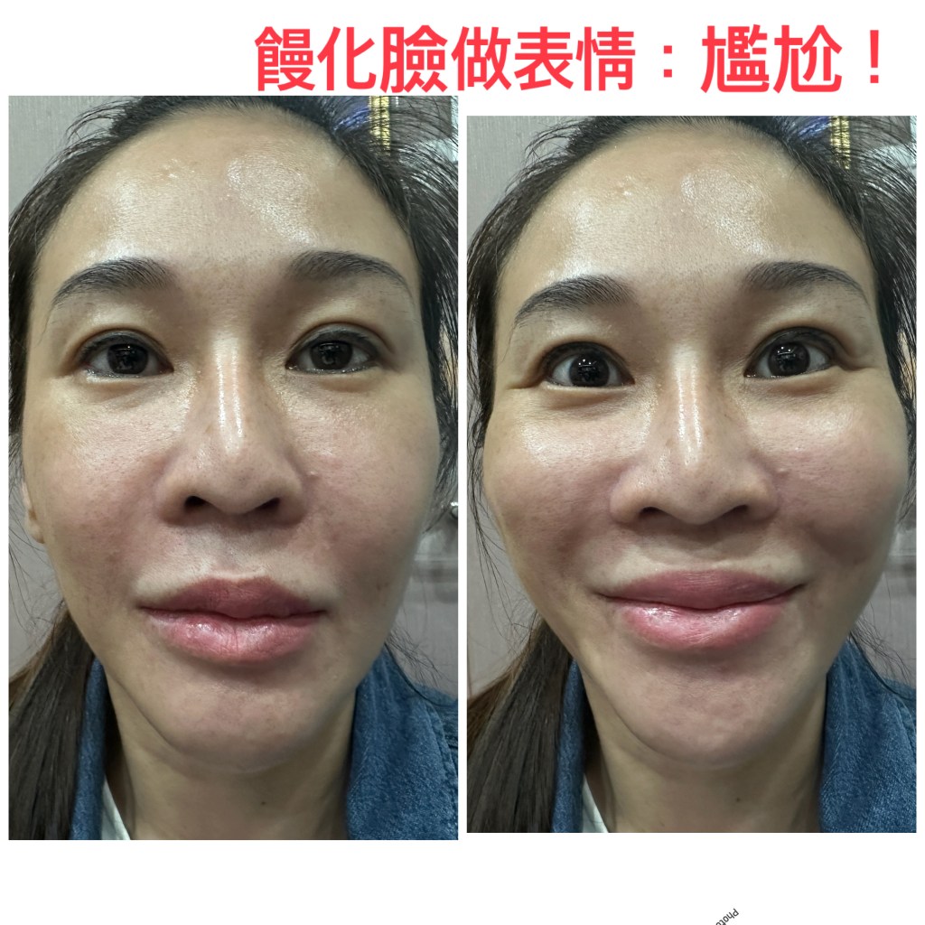 饅化造成表情不自然