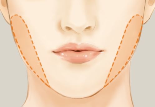 嬰兒肥形成的臉型範圍