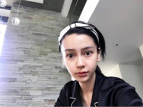 李冠穎醫師:什麼是Y型鼻(Y眉心)?隆鼻都須要墊眉心嗎?Y眉 李冠穎醫師:什麼是Y型鼻(Y眉心)?隆鼻都須要墊眉心嗎?Y眉