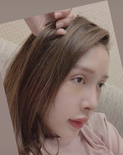 李冠穎醫師:什麼是Y型鼻(Y眉心)?隆鼻都須要墊眉心嗎?Y眉 fullsizeoutput_1de.jpeg - 鼻整形