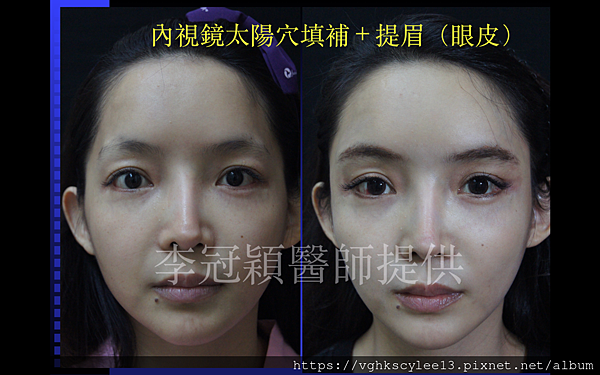 螢幕快照 2017-04-11 下午7.24.52(1).jpg 螢幕快照 2017-04-11 下午7.24.52(1).jpg