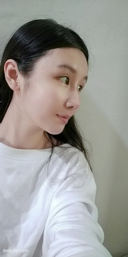 李冠穎醫師:什麼是Y型鼻(Y眉心)?隆鼻都須要墊眉心嗎?Y眉 o9d02fe391cdea8e9d0e9cef8623374df_57043318_201124_1.jpg - 鼻整形