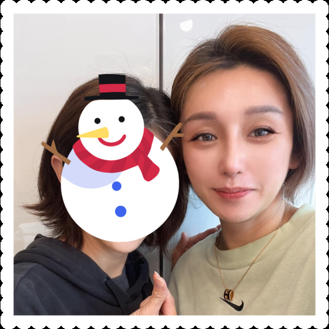 李冠穎醫師:什麼是Y型鼻(Y眉心)?隆鼻都須要墊眉心嗎?Y眉 IMG_9375.PNG - 額眉