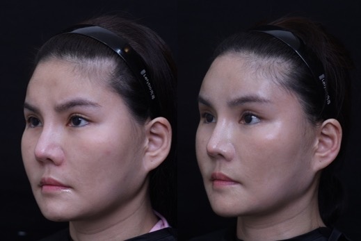 /tmp/phpX8oIVJ /tmp/phpX8oIVJ