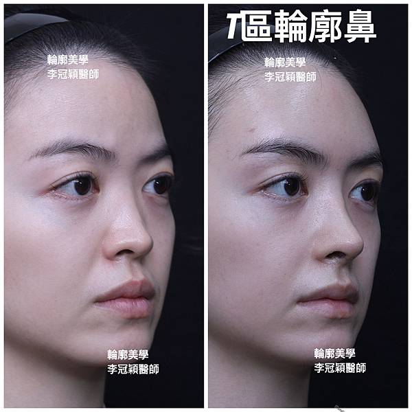 /tmp/phpyKbhEC /tmp/phpyKbhEC