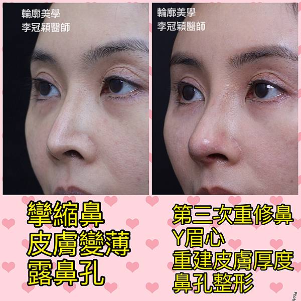 /tmp/phptEW5hH /tmp/phptEW5hH