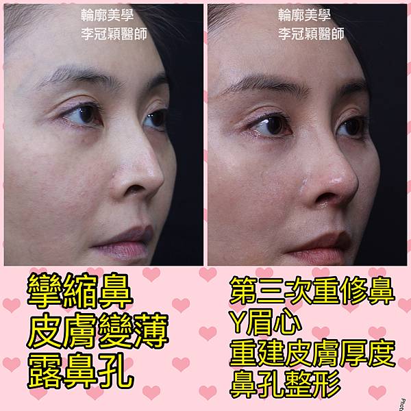 /tmp/phpVDg8uM /tmp/phpVDg8uM