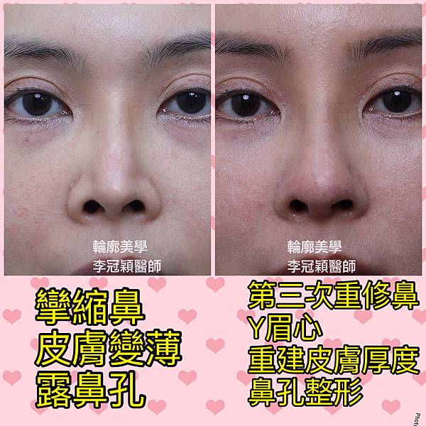 /tmp/phpLsqQfT /tmp/phpLsqQfT