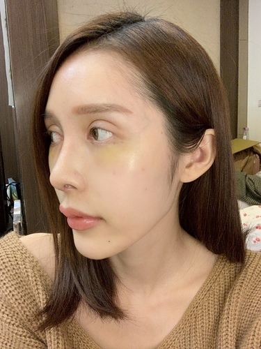 搶救失敗隆鼻三:沒有條件如何隆鼻?正解:輪廓解析隆鼻術(避免 IMG_0404.JPG - 鼻整形
