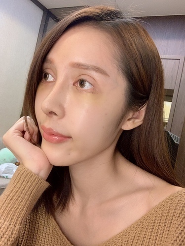 搶救失敗隆鼻三:沒有條件如何隆鼻?正解:輪廓解析隆鼻術(避免 IMG_0407.JPG - 鼻整形