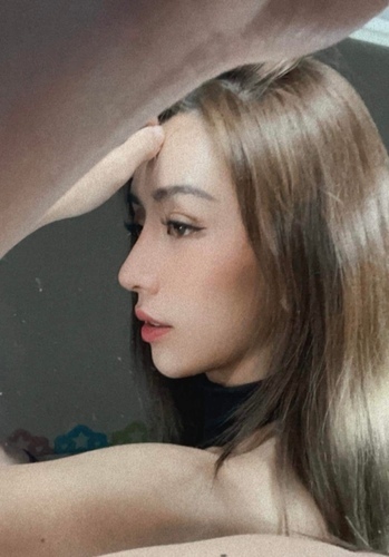 隆鼻最好材料? 誰不容易取出?誰會感染?誰會吸收變形?搶救 273496299_4988193771218601_6541071459306439186_n.jpeg - 墊煤骨