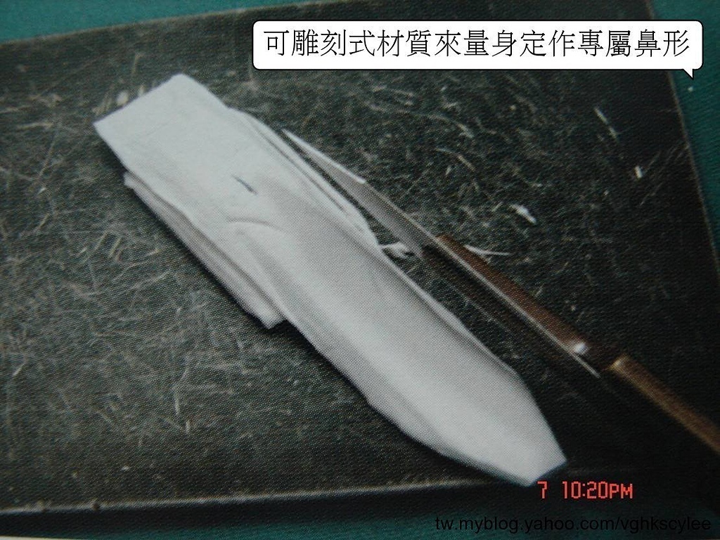 隆鼻最好材料? 誰不容易取出?誰會感染?誰會吸收變形?搶救 隆鼻最好材料? 誰不容易取出?誰會感染?誰會吸收變形?搶救