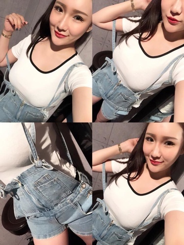 隆鼻最好材料? 誰不容易取出?誰會感染?誰會吸收變形?搶救 38948688_2139248652783595_8023034866394202112_n.jpg - 鼻整形