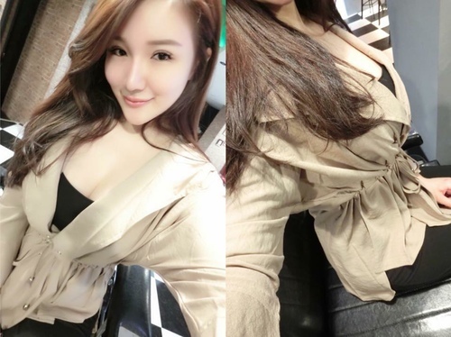 隆鼻最好材料? 誰不容易取出?誰會感染?誰會吸收變形?搶救 40586085_2179969195378207_4816884166962446336_n.jpg - 鼻整形