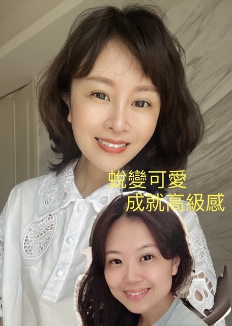 隆鼻最好材料? 誰不容易取出?誰會感染?誰會吸收變形?搶救 隆鼻最好材料? 誰不容易取出?誰會感染?誰會吸收變形?搶救