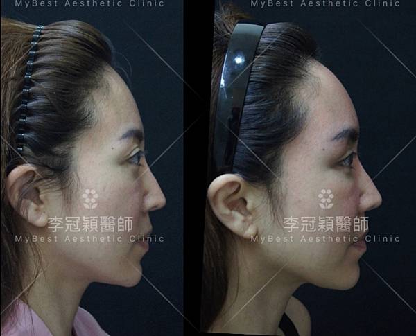 IMG_8658.JPG - 額眉