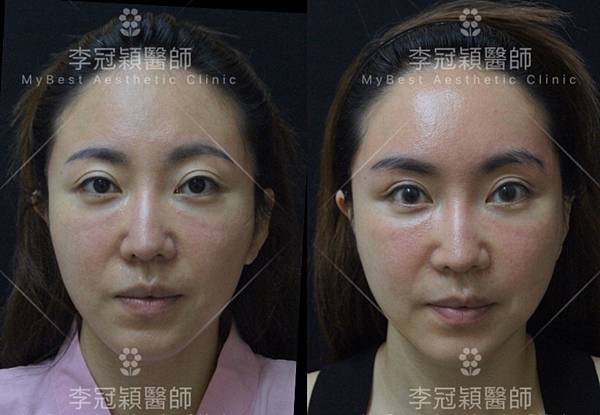 IMG_8660.JPG - 額眉