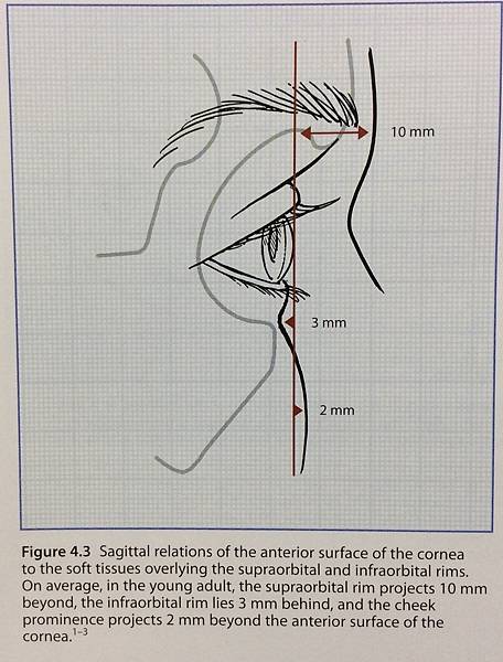 搶救失敗隆鼻三:沒有條件如何隆鼻?正解:輪廓解析隆鼻術(避免 搶救失敗隆鼻三:沒有條件如何隆鼻?正解:輪廓解析隆鼻術(避免