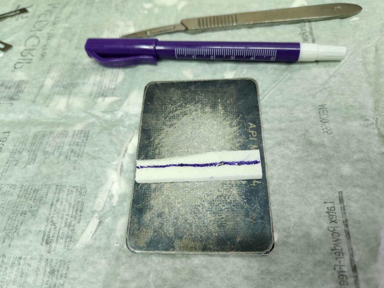 隆鼻最好材料? 誰不容易取出?誰會感染?誰會吸收變形?搶救 隆鼻最好材料? 誰不容易取出?誰會感染?誰會吸收變形?搶救