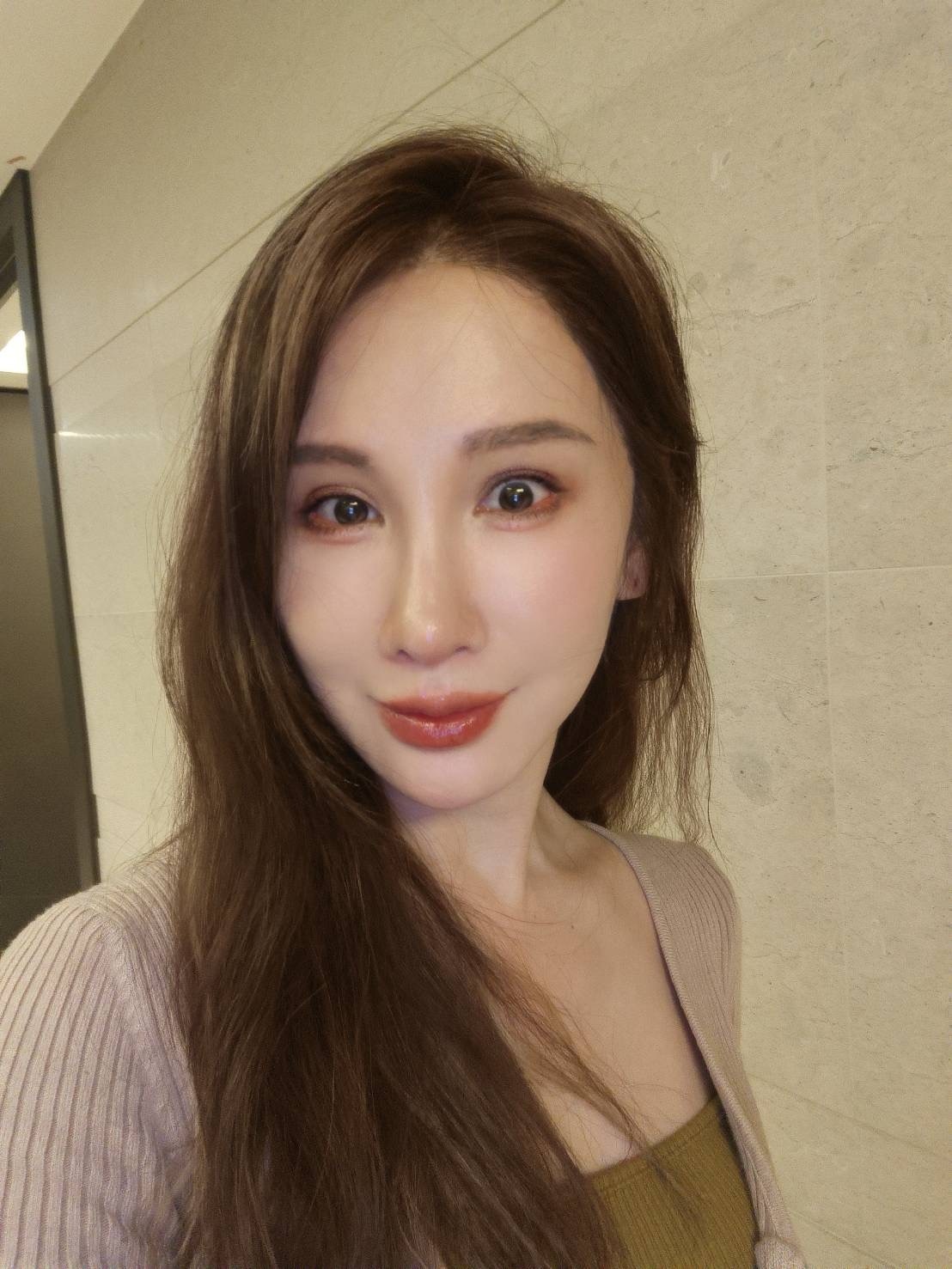 隆鼻最好材料? 誰不容易取出?誰會感染?誰會吸收變形?搶救 隆鼻最好材料? 誰不容易取出?誰會感染?誰會吸收變形?搶救