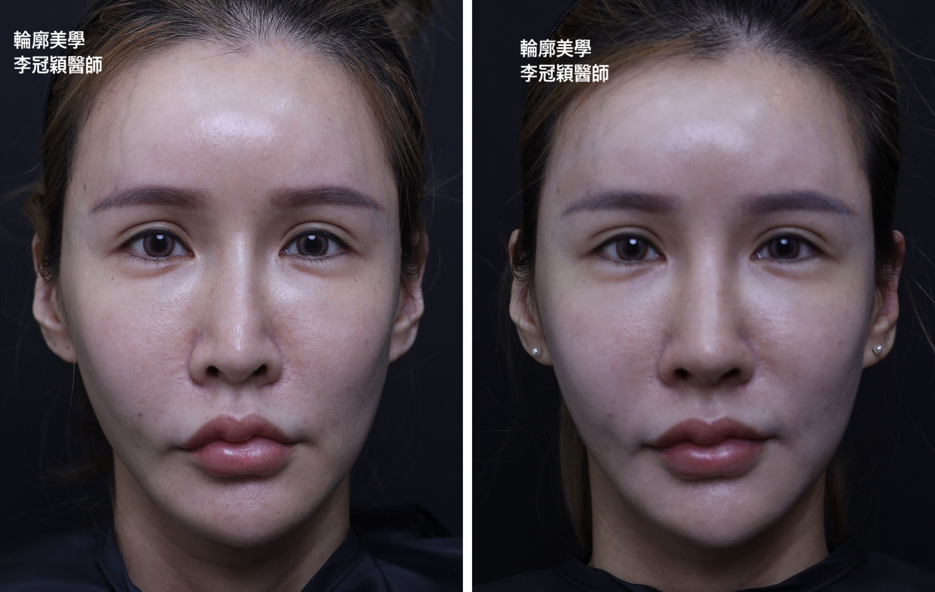 /tmp/phpVaTxee /tmp/phpVaTxee