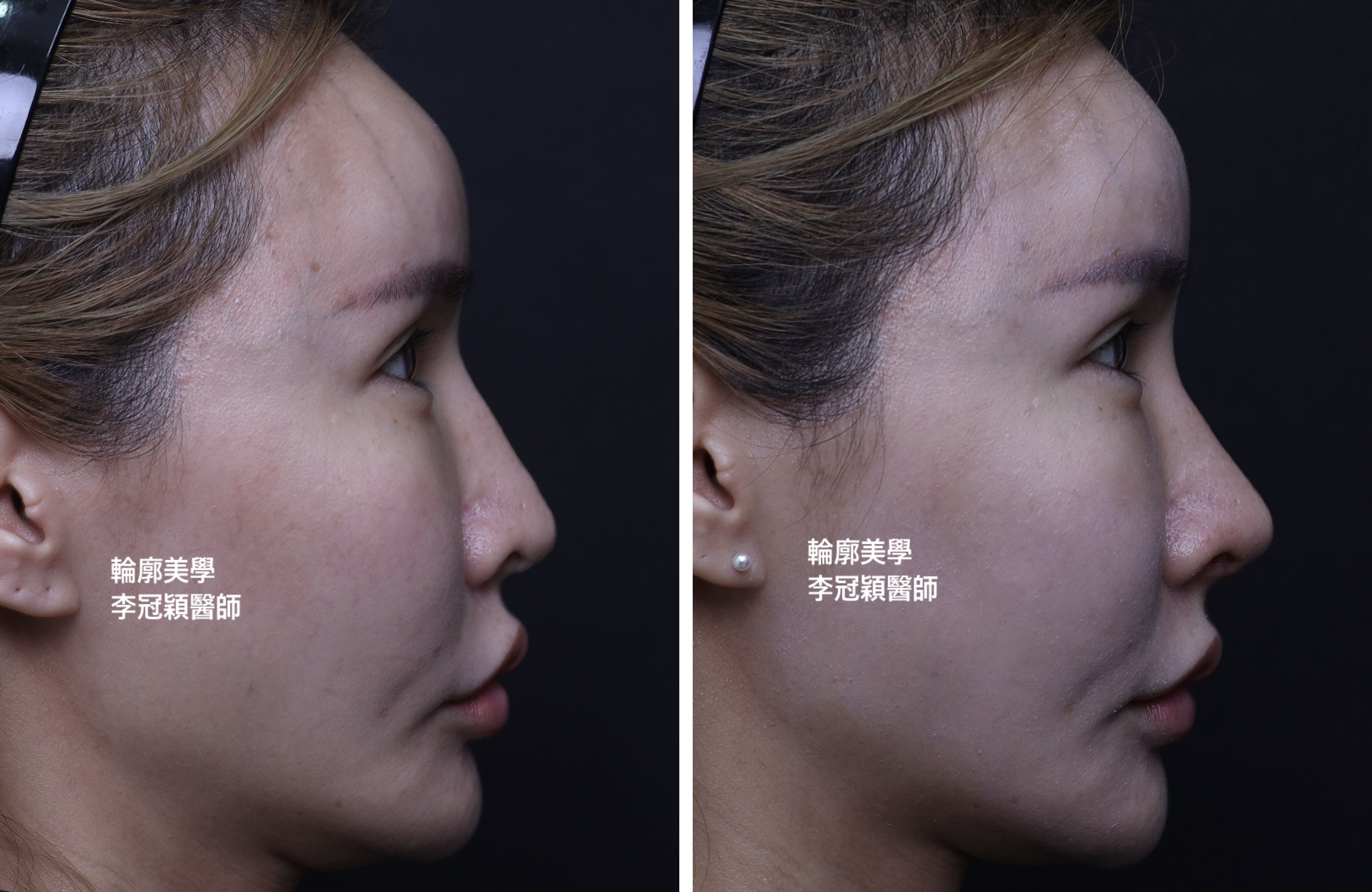 /tmp/phpnKjMQ3 /tmp/phpnKjMQ3