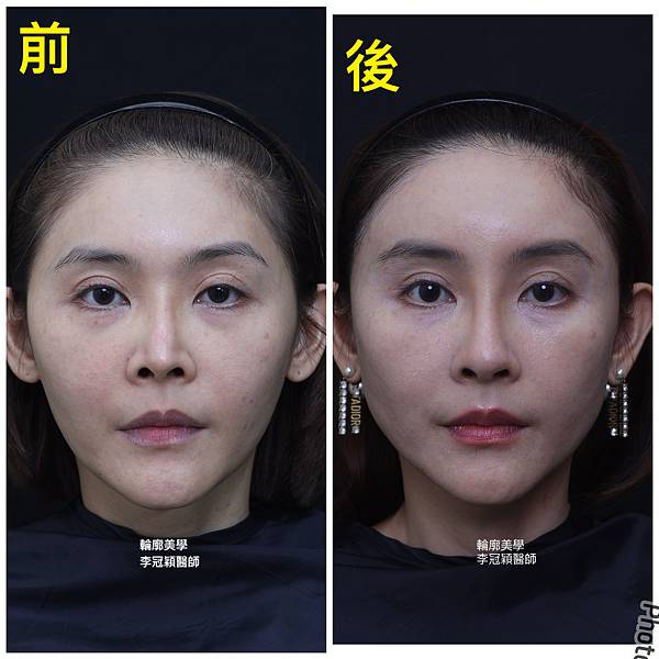 /tmp/phpLXGJlz /tmp/phpLXGJlz