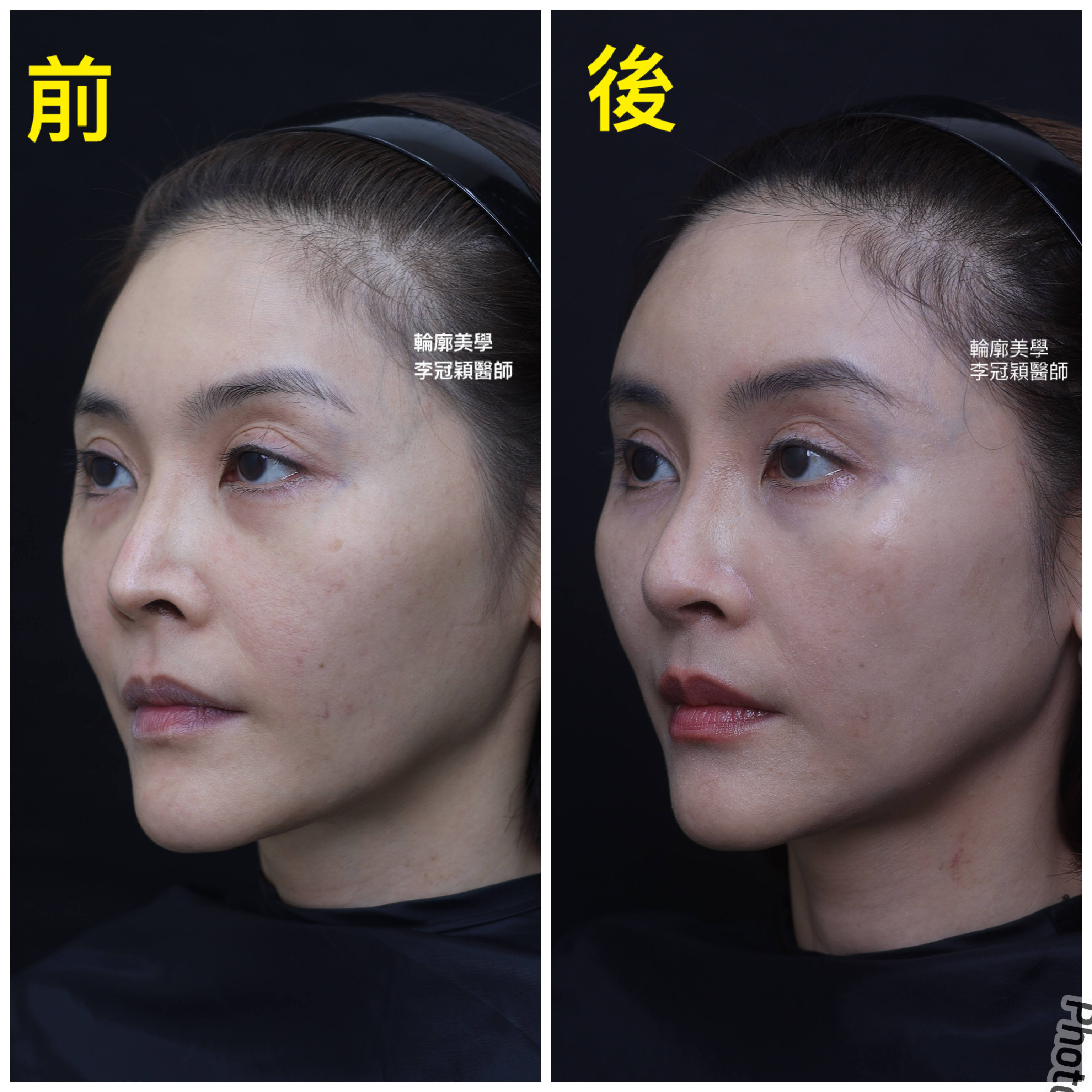 /tmp/php6RAwmJ /tmp/php6RAwmJ