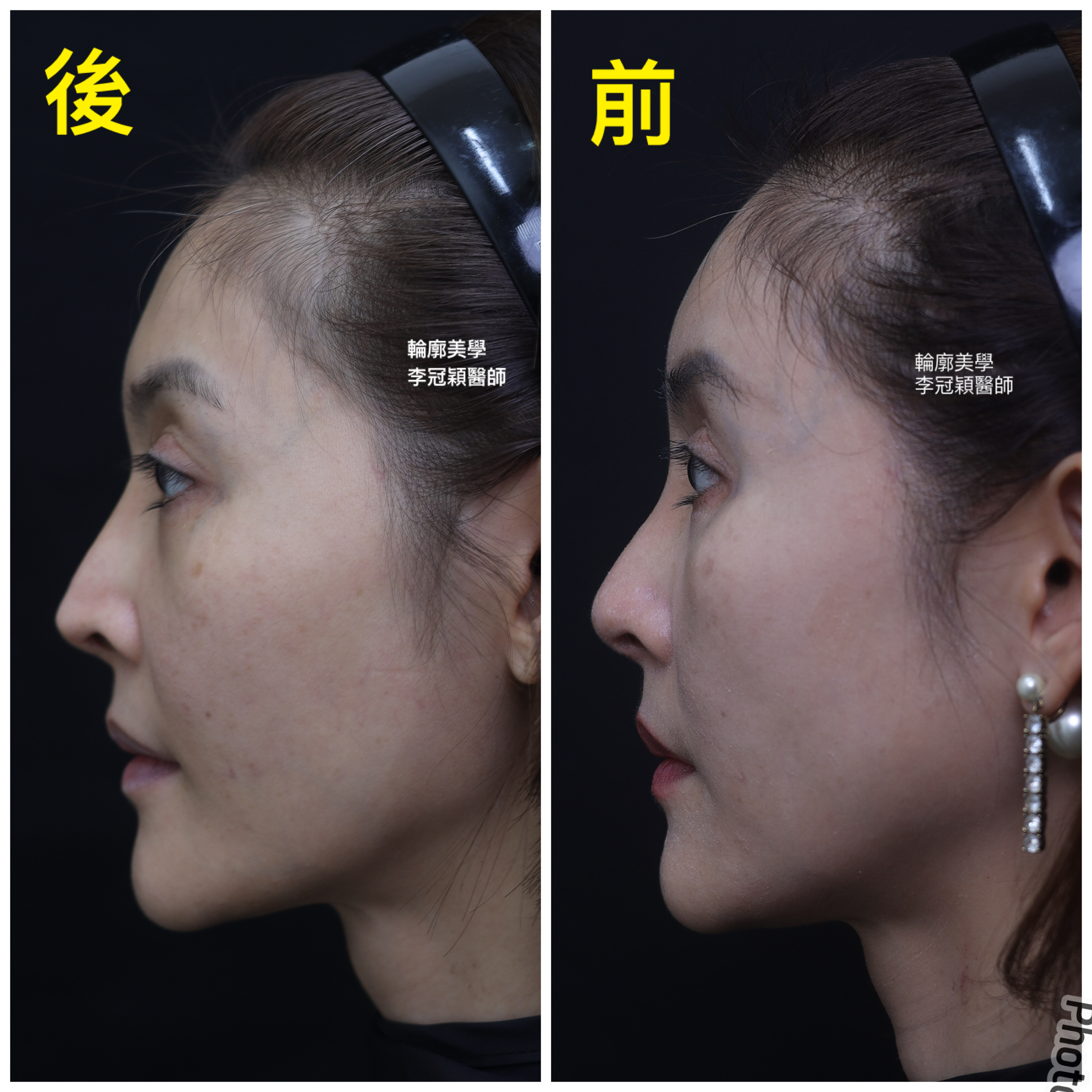 /tmp/phpvTXWs9 /tmp/phpvTXWs9