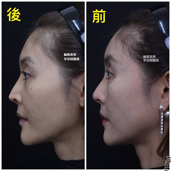 /tmp/phpvTXWs9 /tmp/phpvTXWs9