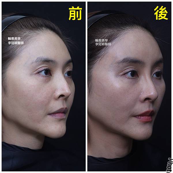 /tmp/phpuN9BEA /tmp/phpuN9BEA