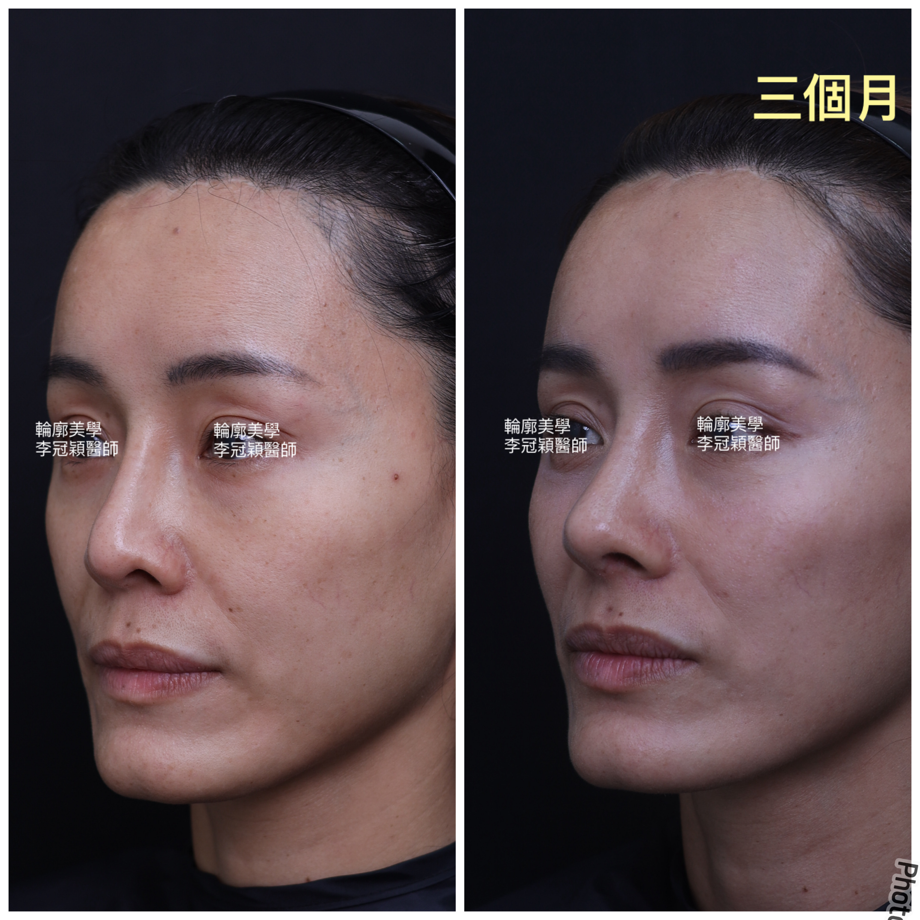 /tmp/phpzKrFSS /tmp/phpzKrFSS