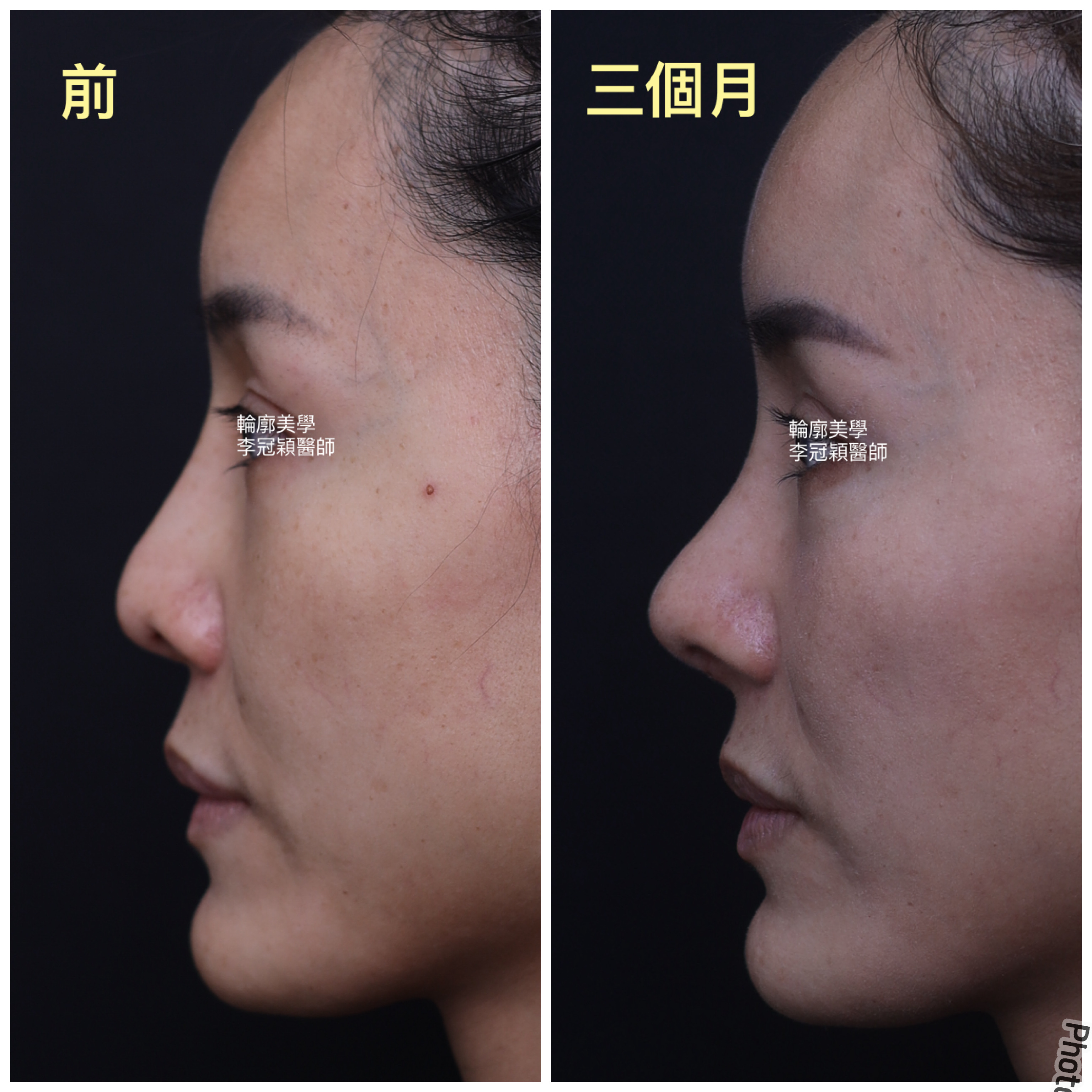 /tmp/phptwx4ZW /tmp/phptwx4ZW